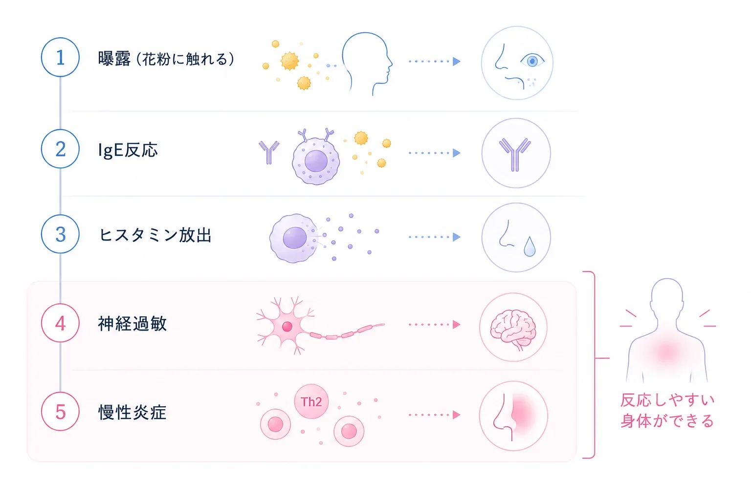 曝露→IgE反応→ヒスタミン放出→神経過敏→慢性炎症のカスケード