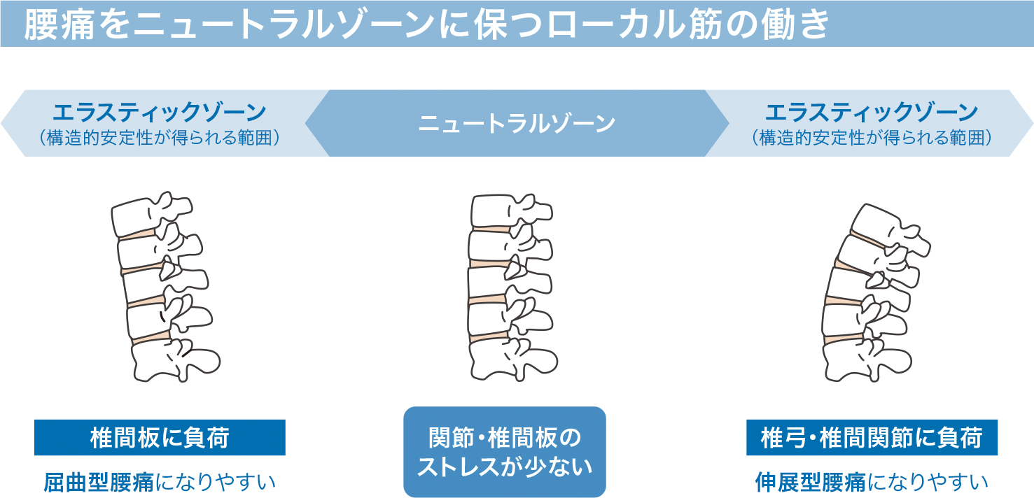 腰痛をニュートラルゾーンに保つローカル筋の動き